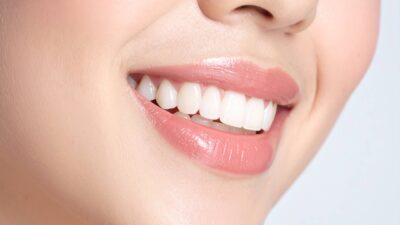 Bọc Răng Sứ Zirconia Chính Hãng Giá Tốt Tại Nam An