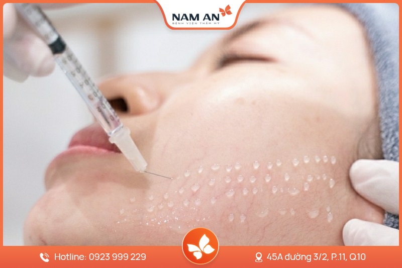 Needle mesotherapy in beauty clinic. Cosmetics injected to woman