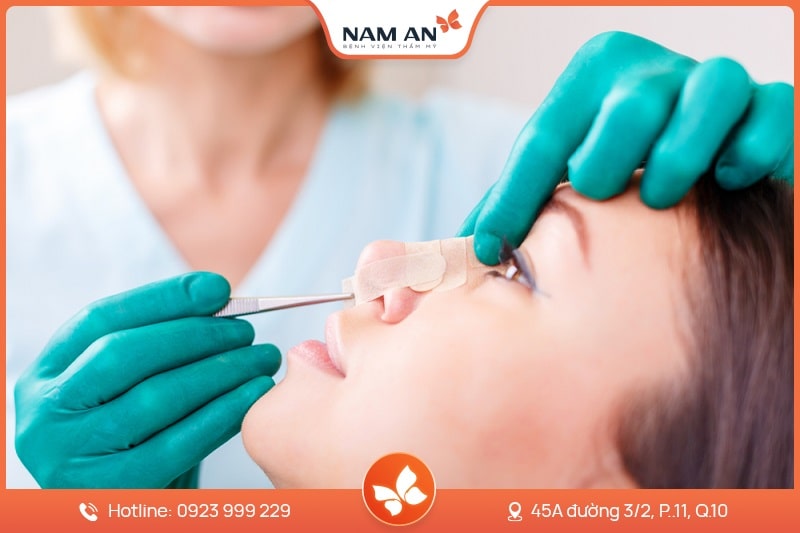 Nâng Mũi Bọc Sụn Tự Nhiên, Ngăn Biến Chứng Tại Nam An (8)