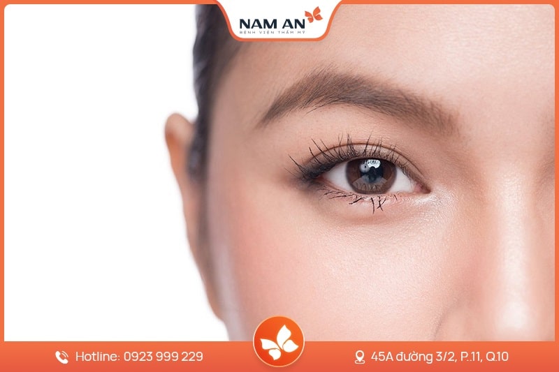 Phẫu Thuật Cắt Mắt 2 Mí Đẹp Tự Nhiên Tại BVTM Nam An (4)
