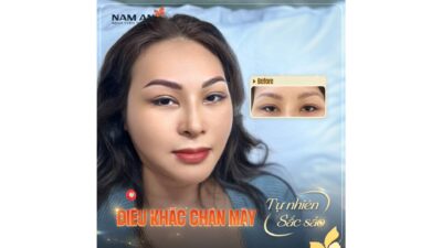 Top 5 Dịch Vụ Chăm Sóc Da Đón Tết Rạng Rỡ Tại Nam An