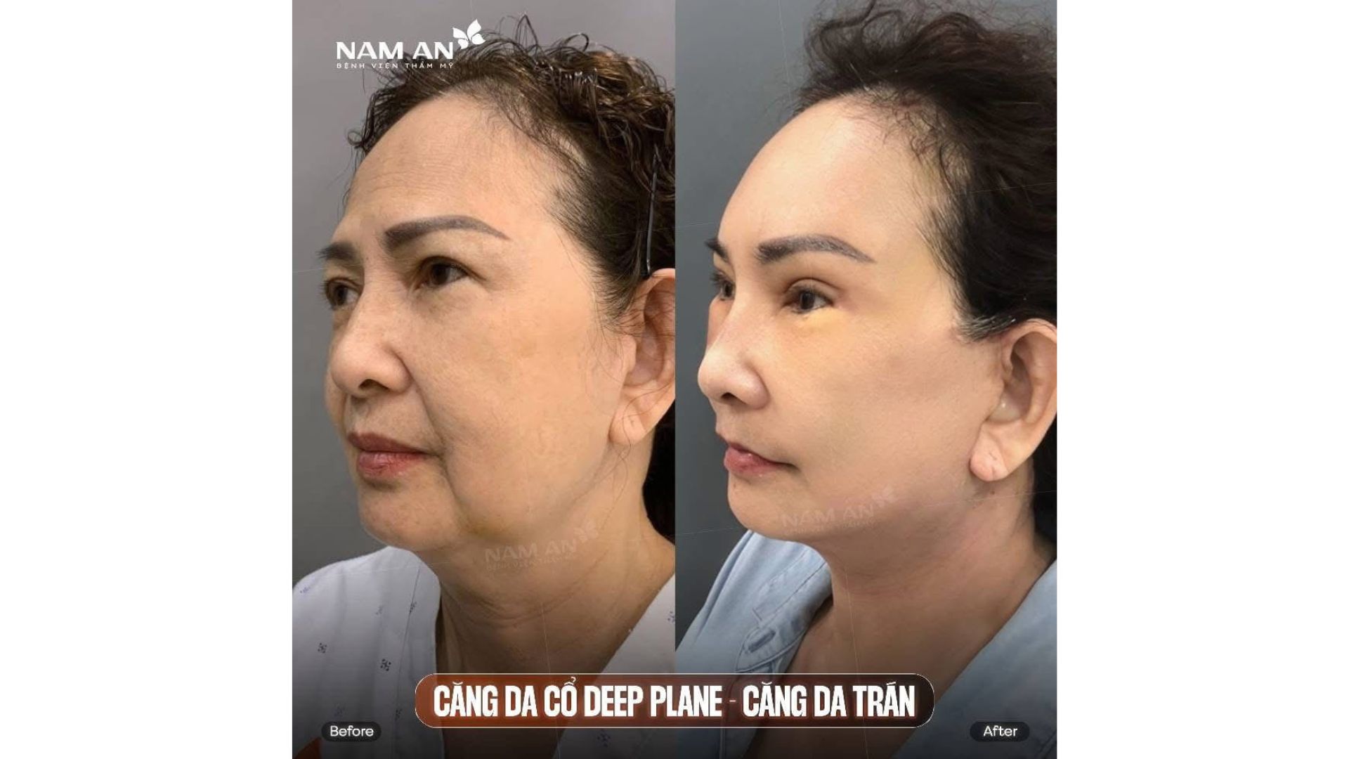 Top Dịch Vụ Được Yêu Thích Nhất Tại BVTM Nam An (6)